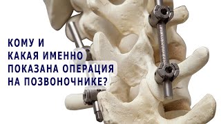 Кому и какая именно показана операция на позвоночнике?