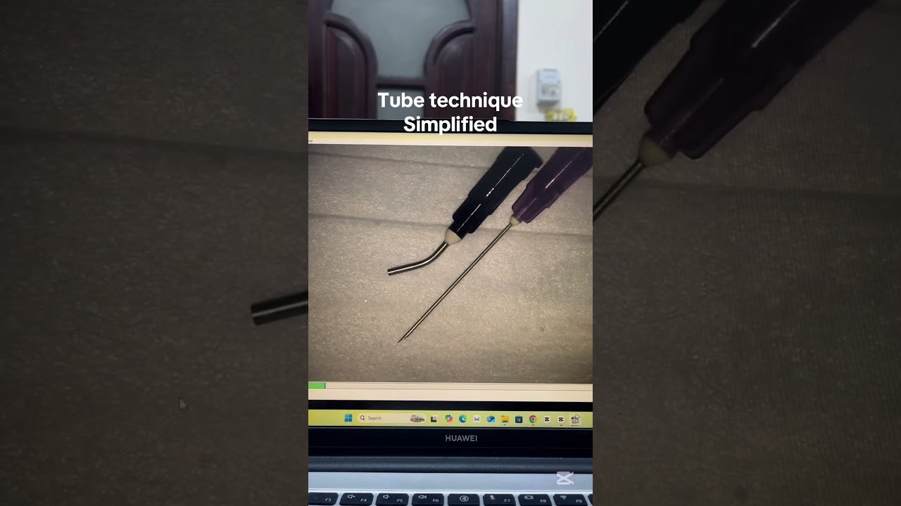 Endodontics: Using tube technique for broken file retrieval ( Arabic Demo)