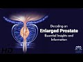 Enlarged Prostate Explained: Symptoms, Causes, and Treatments