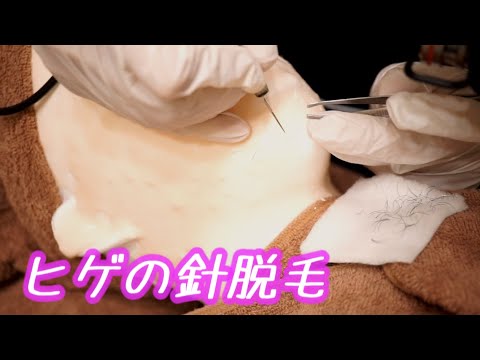 【ASMR】メンズエステロールプレイひげのニードル脱毛/Beard Needle Hair Removal Roleplay
