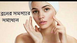 Acne Prone Skin Care Routinestep By Stepget Glowing,Spotless And Clear Skin How To Remove Acne
