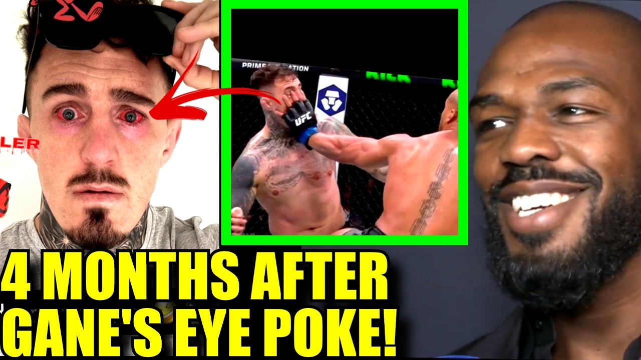 THIS IS WHAT CIRYL GANE EYE POKE DID TO TOM ASPINALL'S EYES,JON JONES KNOWINGLY LEAKED HIS INJURY?
