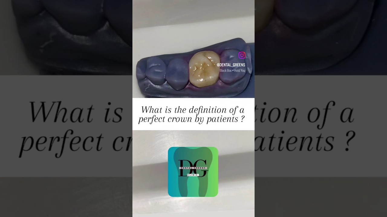 What is the perfect crown or cap by the  patients ? 