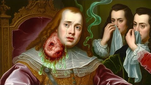 How The Teenage King of France Succumbed After an Ear Infection Spread to His Skull