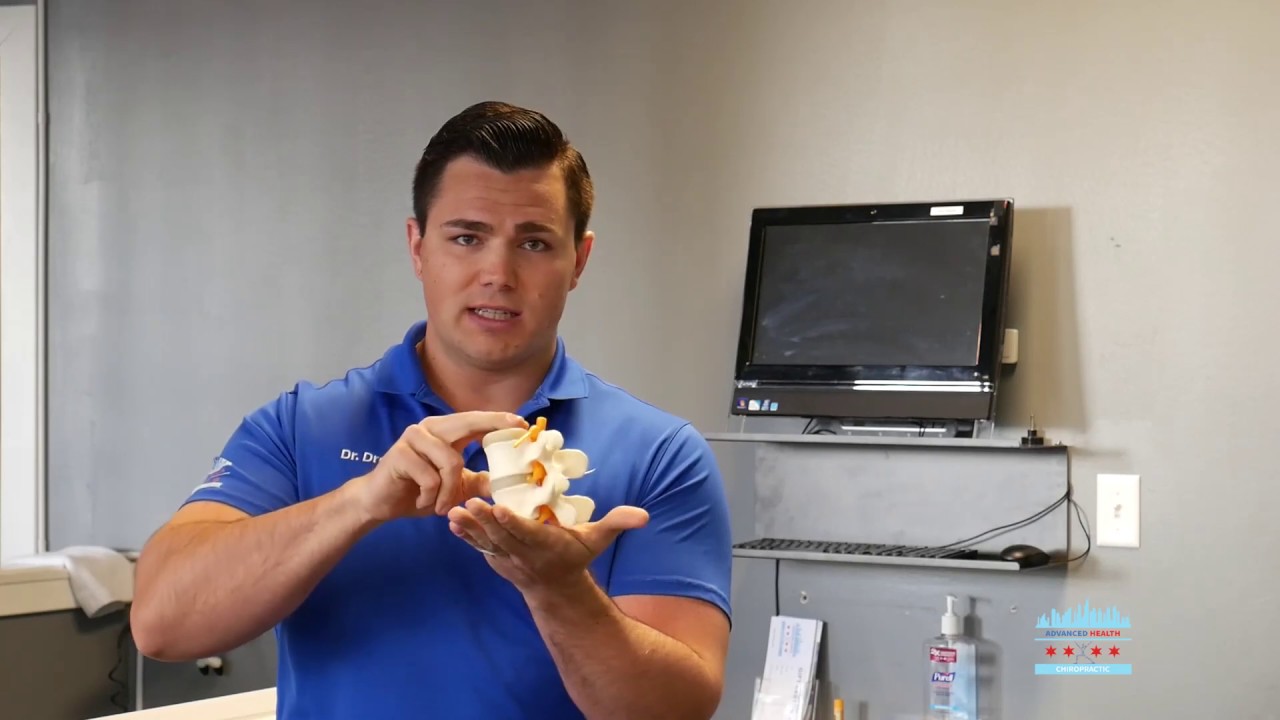 Sciatica Center Chicago IL Chiropractic Treatment