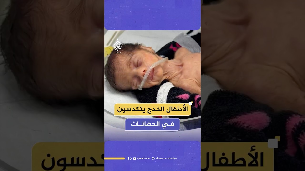 الأطـ ـفال الخدج يتكدسون في الحضانات بمستشفى ناصر الحكومي في خان يونس
