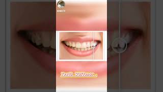 HOW  TO WHITE TEETH youtubeshorts youtubeytshort trend dentaltechnician