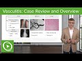 Vasculitis: Case Review and Overview | Lecturio