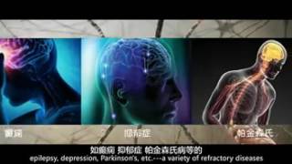 Introduction of HMI