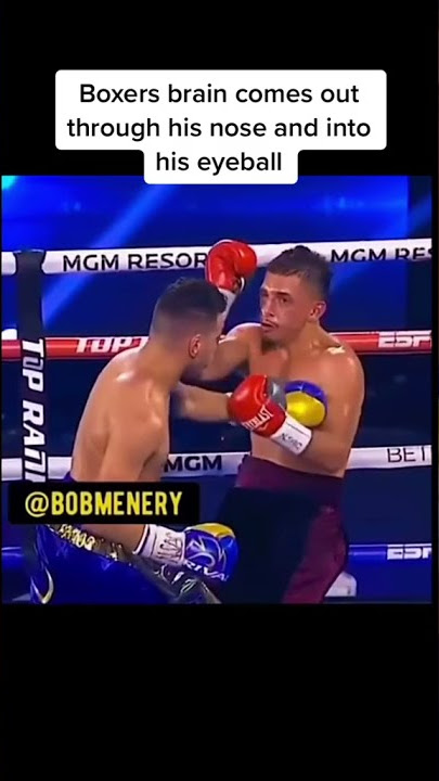 Boxers Brain Comes Out Of Nose 🧠👃🤯 #boxing #boxer #2021 #fighter #fight #highlight #braindamage #fyp