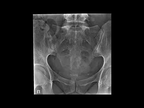 Укладка для снимкам крестца