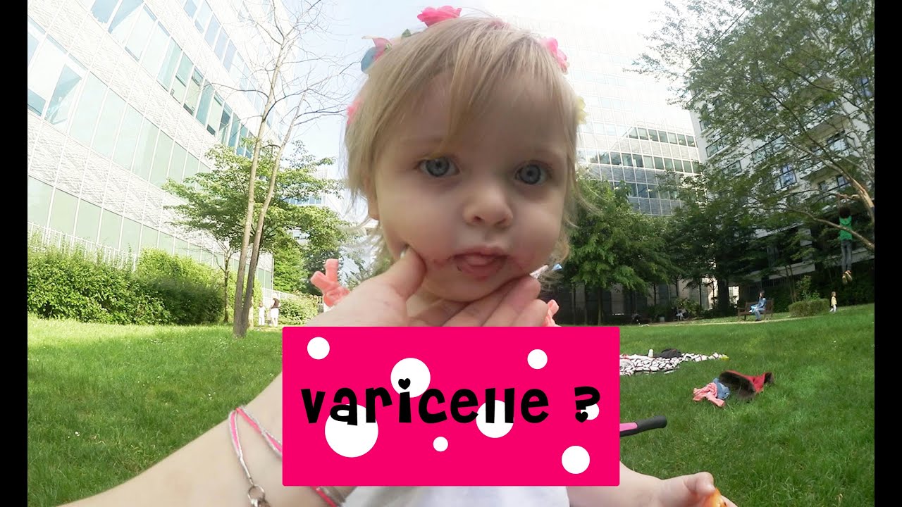Une Journee Avec Nous Bebe A La Varicelle Youtube