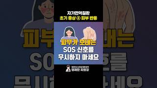 피부 반응으로 알아보는 자가면역질환 (루푸스, 자가면역성 간염)