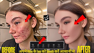 👉 Video में Face Smooth कैसे करें | Remove Pimples & Acne Instantly | Wink App Editing Tutorial 2025