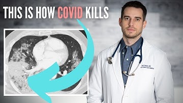 코로나 바이러스 : COVID 19가 일부 사람은 죽이지 만 다른 사람은 죽이지 않는 방법-저는 폐 의사입니다 (의학적 진실)