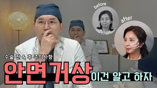 안면거상 계획하시는 분들은 제발 봐주세요