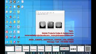 Mammogram classification using Deep learning CNN | www.matlabprojectscode.com