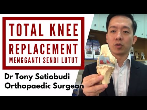 Video: Cara Mengatasi Nyeri Setelah Operasi Penggantian Lutut: 11 Langkah