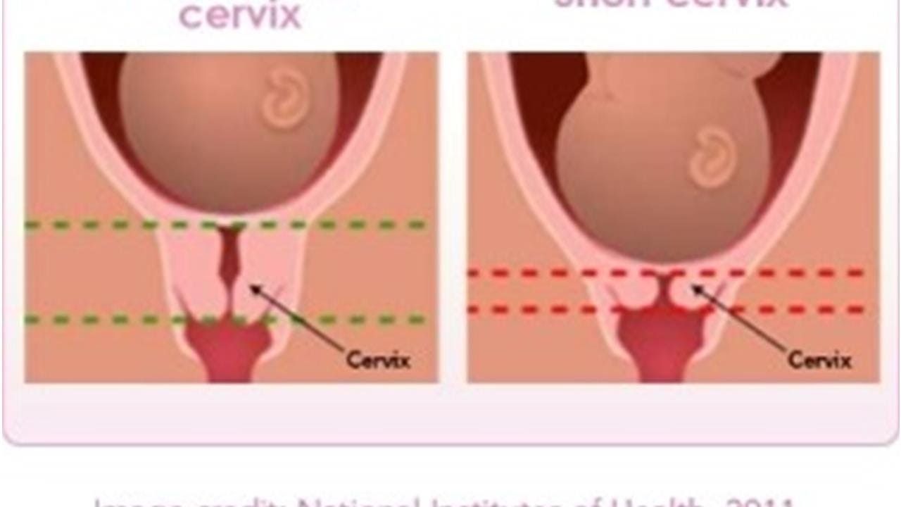 оргазм при беременности и короткая шейка матки при беременности фото 4