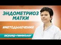 Лечение эндометриоза матки. Симптомы, диагностика, а также  методы лечения эндометриоза.