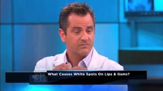 White Spots on Lips Medical Course