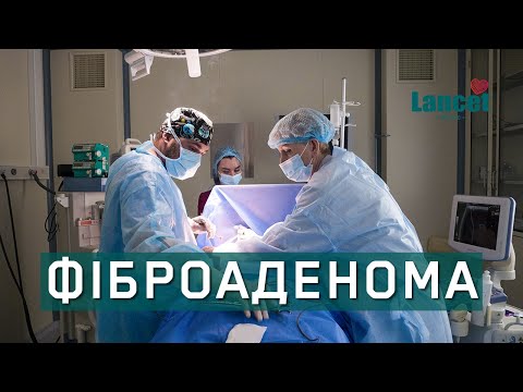 Видалення фіброаденоми молочної залози в медичному центрі Lancet