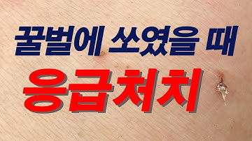 꿀벌에 쏘였을 때 응급처치, 통증이나 가려움 뚝, 신통합니다.