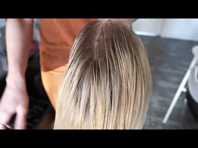 Video protesi capelli con persone reali - HRS SHOP