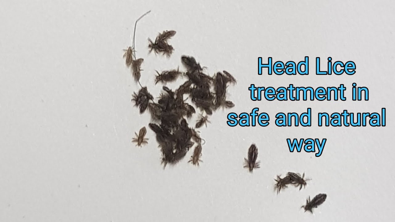 lice treatment in safe and natural way licetreatment headlice kuto