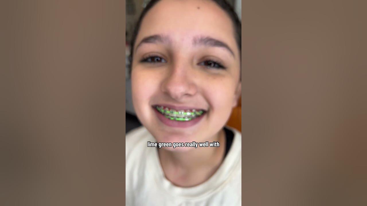 Is Lime Green a Good Braces Color to Pick for St. Patrick's Day? - YouTube