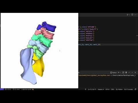 Visualizing Multiple 3D Objects in Medical Imaging with vedo and Python ...