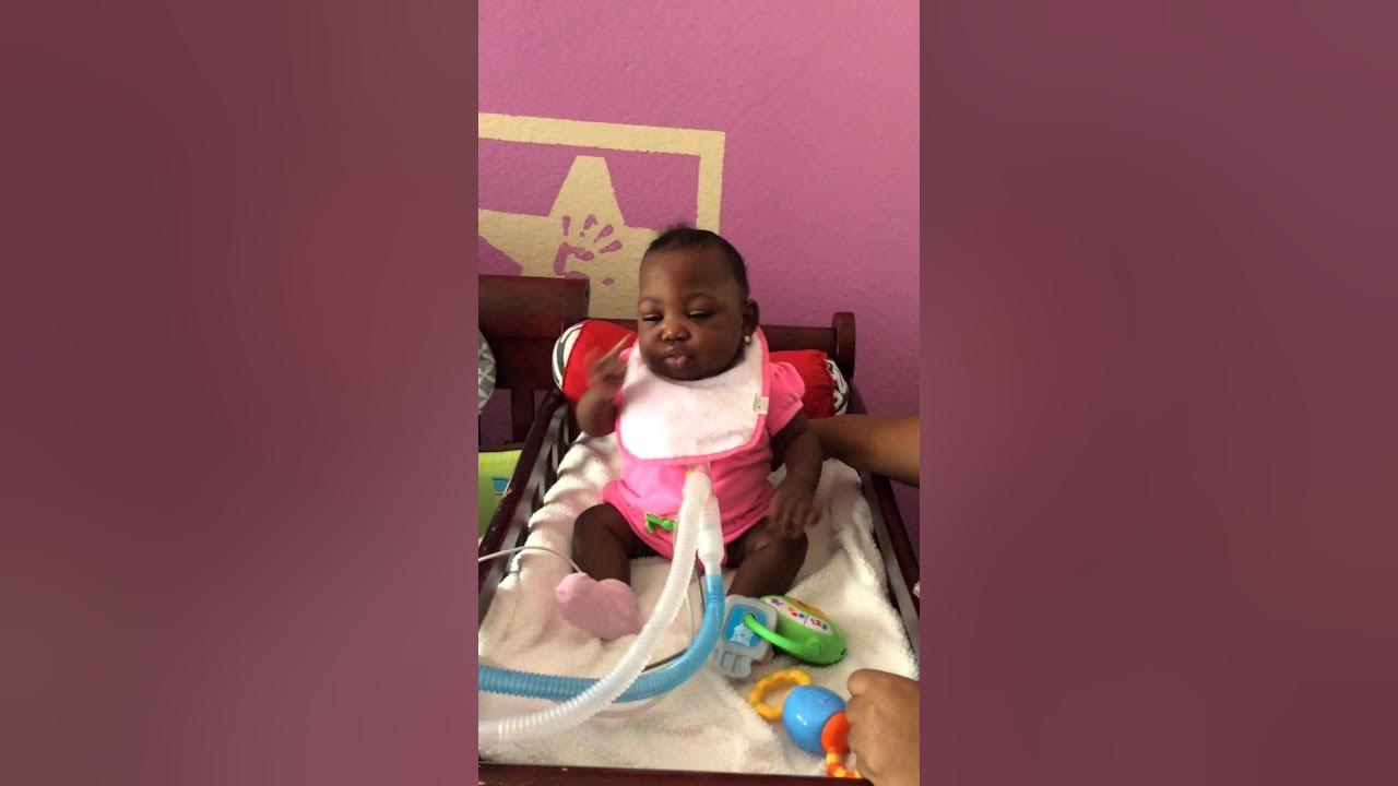 Tajoi the baby with tracheostomy tube YouTube