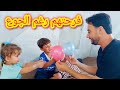 اشترينا طحين ظهور اعراض على جلد ميرا لايفوتكم اشترينا طحين ظهور اعراض على جلد ميرا لايفوتكم