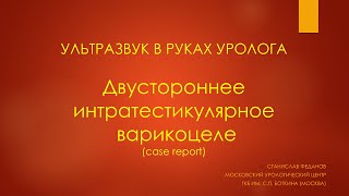 Интратестикулярное варикоцеле. Ультразвук в руках уролога.