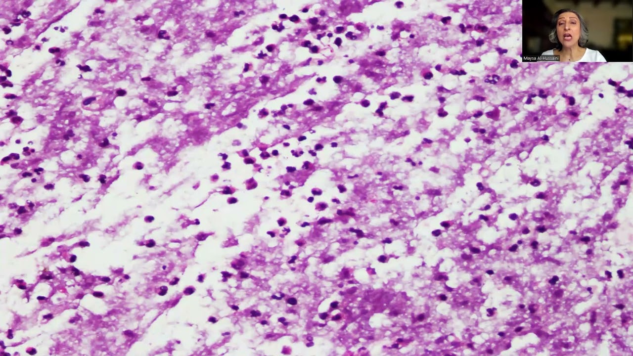 Tip-34; Fungal Contamination