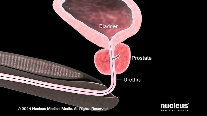 What is Benign Prostatic Hyperplasia (BPH)? - DayDayNews