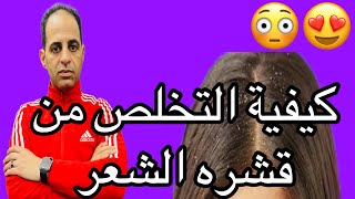 كيفية علاج التخلص من قشره الرأس??