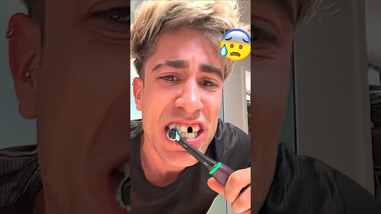Alejo igoa LLORA porque Se le CAE UN DIENTE 😭🤣