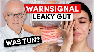 Anzeichen Leaky Gut: Was dahinter steckt und was sie tun können (wichtig!)