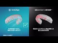 【インビザライン】どのマウスピース矯正を選ぶ?