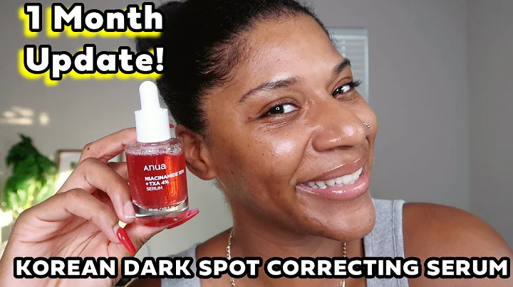 1 Month Update - Anua Niacinamide TXA Serum for Hyperpigmentation on Dry Skin
