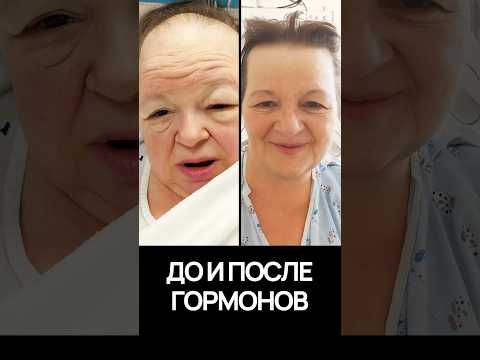 АМУЗИЯ – БОЛЕЗНЬ? или ОСОБЕННОСТЬ? #наука #музыка #мозг