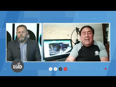 EL DIA D   PROGRAMA 200