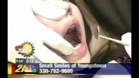 Dr. Michael Crites on NBC Youngstown