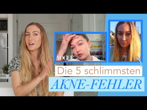 Video: Gesichtsbehandlungen Für Akne: 6 Arten, Allgemeine Schritte, DIY, Mehr