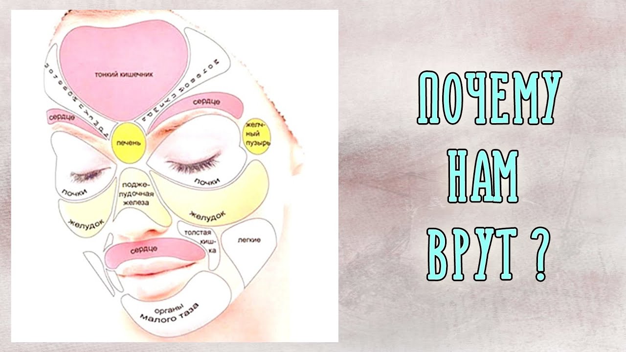 За какие органы отвечают прыщи на лице. Карта прыщей на лице. Карта прыщей на лице у женщин. Прыщи на лице карта органов. Зоны прыщей на лице и органы.