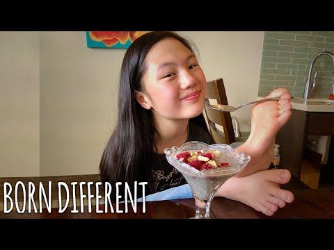 Our Incredible Girl With No Arms | BORN DIFFERENT