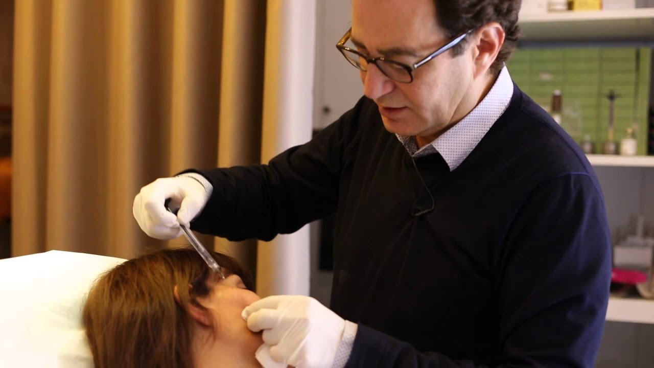 Comblement des fossettes et des lèvres