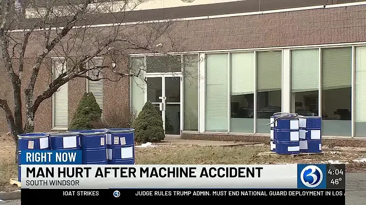 Employee hospitalized after arm trapped in machine at South Windsor business
