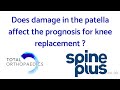 Does Damage In The Patella Affect The Prognosis For A Knee Replacement Does Damage In The Patella Affect The Prognosis For A Knee Replacement